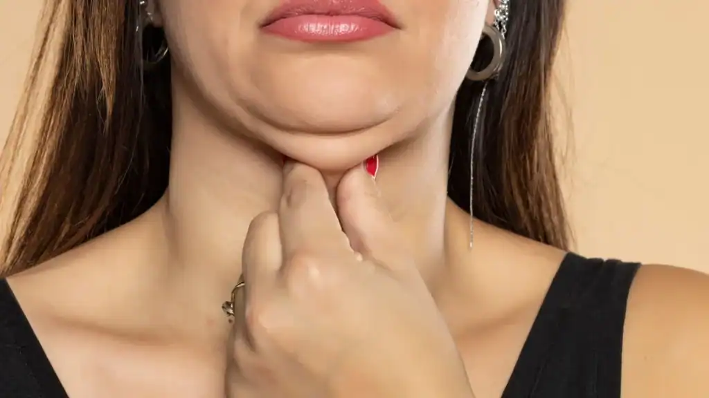 An image of a woman with double chin, sad, worried : Non Surgical Double Chin Removal Treatment in Stoke on Trent, UK