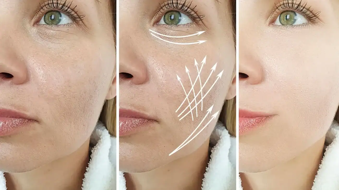 Can One Treatment Really Tackle More Than One Skin Concern Stoke on Trent?