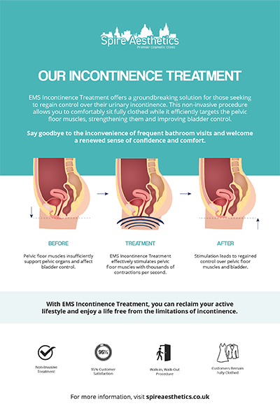 image to show how EMS treatment works for female urinary incontinence Stoke on Trent