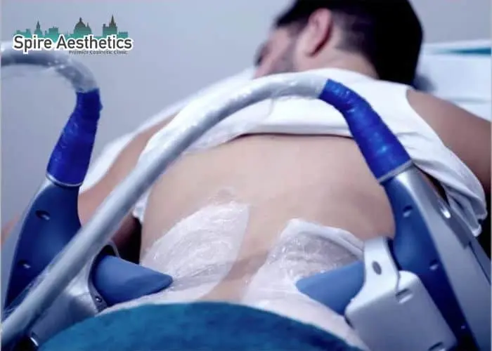 Man having fat freezing treatment done on love handles before a competitions Stoke on Trent to create a sculpted look.