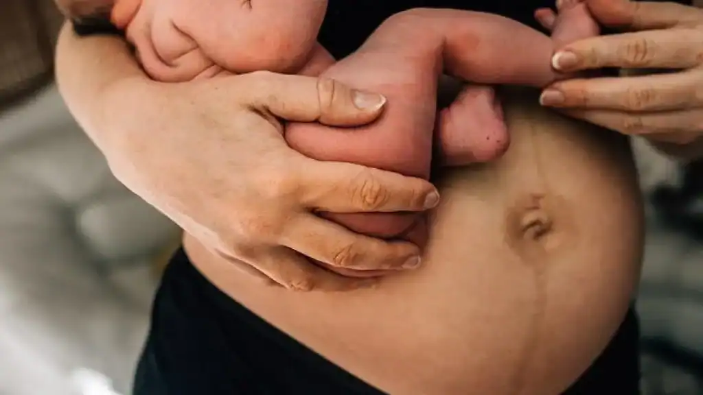 Why Is My Stomach Still Big After Pregnancy Stoke on Trent?